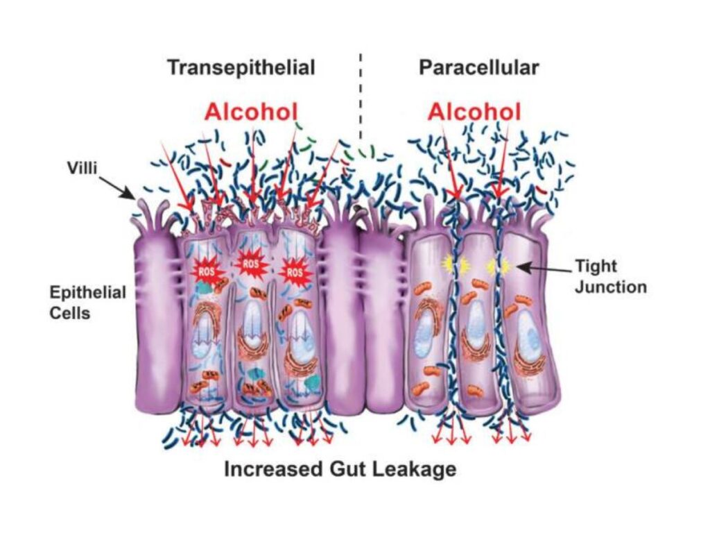 Illustration showing the effects of alcohol on gut permeability.